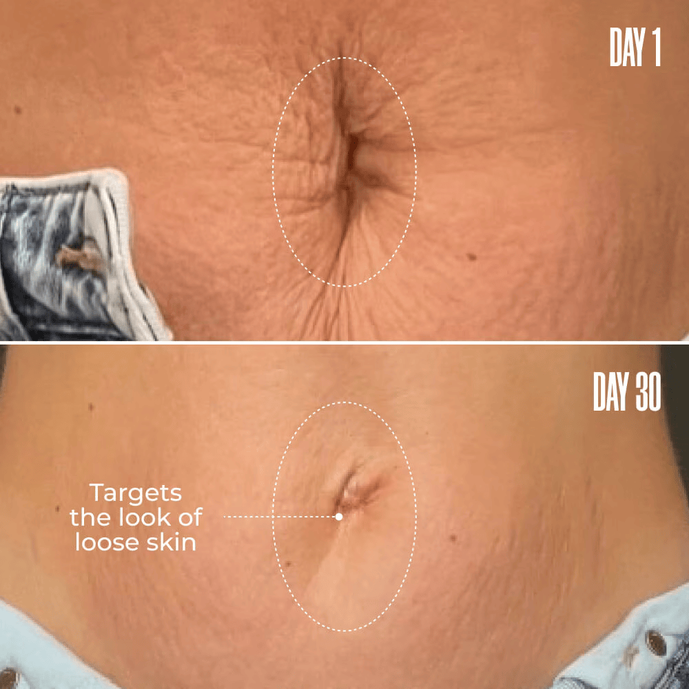 Nelo B-FLAT Belly Firming Cream