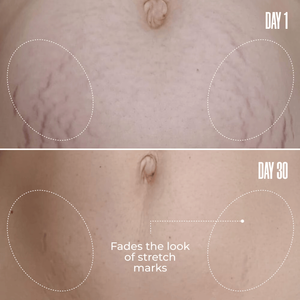 Nelo B-FLAT Belly Firming Cream