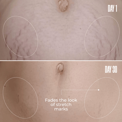 Nelo B-FLAT Belly Firming Cream